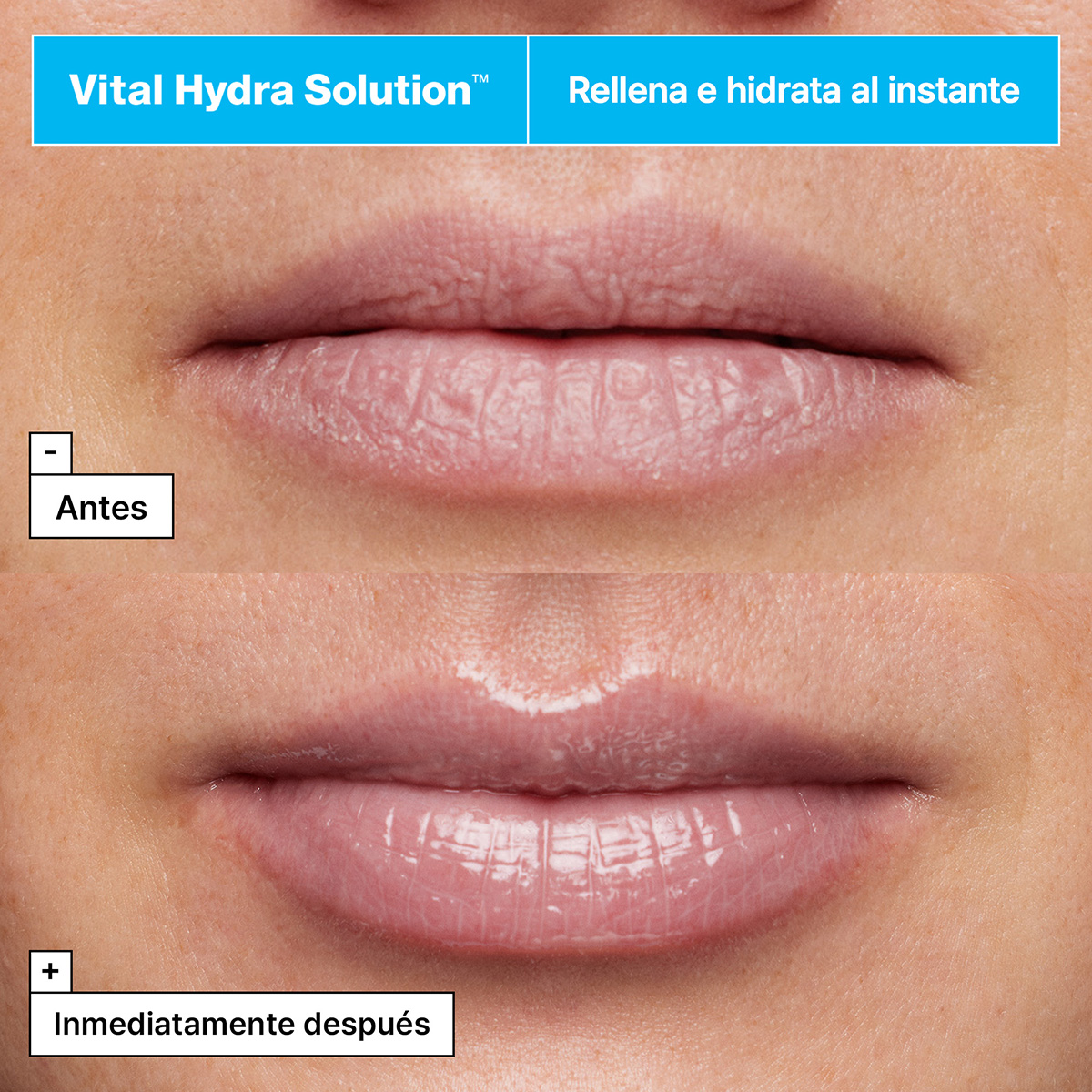 VITAL HYDRA SOLUTION™ JELLY BEAR LIP MASK WITH HYALURONIC ACID (MASCARILLA LABIAL CON ÁCIDO HIALURÓNICO)